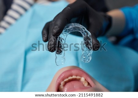 caucasian little kid girl invisible aligner and pointing to her perfect straight teeth. Dental healthcare and confidence concept. Royalty-Free Stock Photo #2115491882