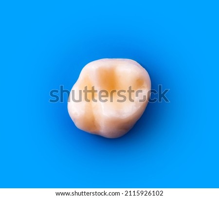 tooth restored by esthetic composite filling  Royalty-Free Stock Photo #2115926102