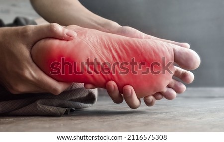 Tingling and burning sensation in foot of Asian young man with diabetes. Foot pain. Sensory neuropathy problems. Foot nerves problems. Plantar fasciitis. Royalty-Free Stock Photo #2116575308