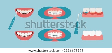 Tooth tartar cleaning. Oral cavity before and after using the water irrigator. Teeth with inflamed gums close-up, healthy smile. Collection flat vector illustration