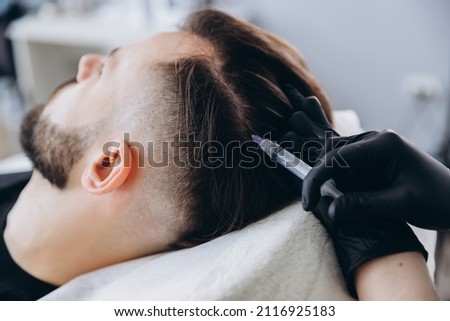 Mesotherapy procedure. A cosmetologist performs a mesotherapy procedure on the head of a young man. Hair strengthening and growth. Royalty-Free Stock Photo #2116925183