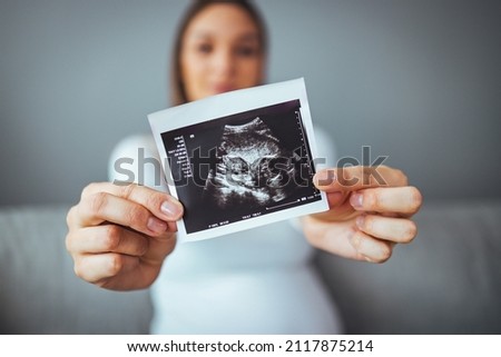 Happy young pregnant woman holding an ultrasound scan image. Smiling beautiful mother with ultrasound of her unborn baby. Pregnancy concept, maternity prenatal care. Royalty-Free Stock Photo #2117875214