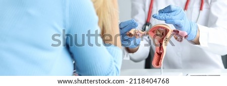 Gynecologist shows ligation of fallopian tubes to patient. Medical surgical sterilization concept Royalty-Free Stock Photo #2118404768
