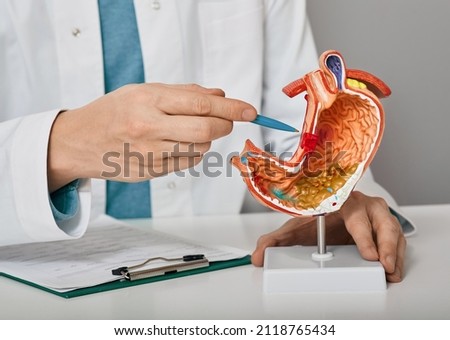 Gastroenterologist consultation, treatment of stomach diseases and ulcers. Doctor pointing to gastric ulcer on anatomical model of stomach Royalty-Free Stock Photo #2118765434
