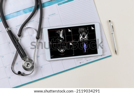 Doctor medical worktable with stethoscope on research in medicine MRI scan of the patient on digital table the planning survey