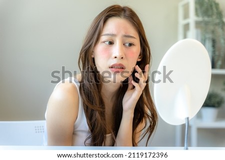 Young woman asian are worried about faces Dermatology and allergic to steroids in cosmetics. sensitive skin,red face from sunburn, acne,allergic to chemicals,rash on face. skin problems and beauty Royalty-Free Stock Photo #2119172396