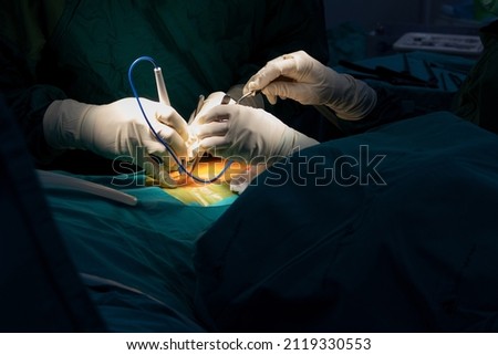 Orthopedic surgeons hands in sterile gloves with specific instruments and a suction tube operating the human spine for minimal invasive spinal surgery Royalty-Free Stock Photo #2119330553