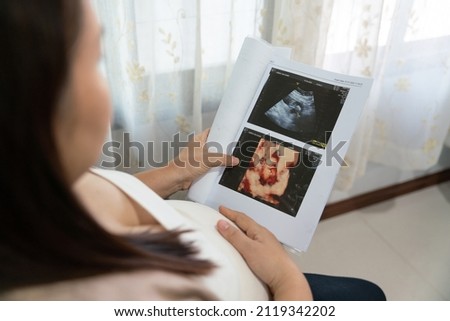Asian young pregnant woman looking at ultrasound image, x-ray pregnant.