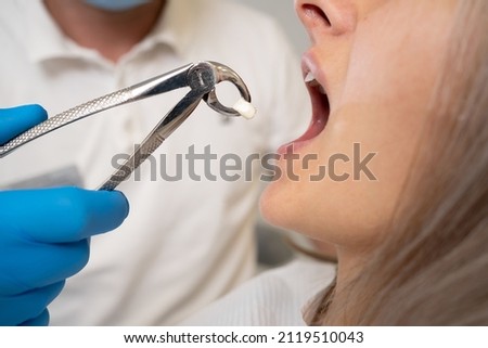 close-up of forceps for extraction of teeth and a tooth in them. The concept of going to the dentist. copy space. Royalty-Free Stock Photo #2119510043