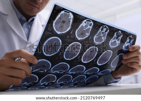 Doctor examining MRI images of patient with multiple sclerosis at table in clinic, closeup Royalty-Free Stock Photo #2120769497