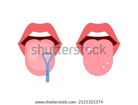 Clean tongue throat cleaner scraper in mouth. Before and after tongue cleaning. Halitosis prevention. Vector illustration Royalty-Free Stock Photo #2121321374