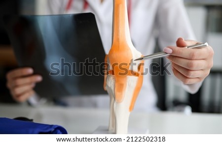Doctor with xray in his hands showing structure of knee joint on artificial model closeup Royalty-Free Stock Photo #2122502318