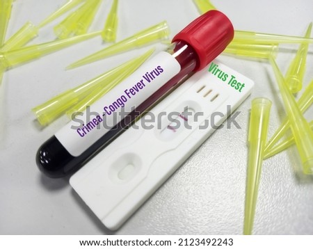 Concept of Laboratory test tube and rapid test kit for Crimea Congo hemorrhagic fever virus test or CCHF test. Royalty-Free Stock Photo #2123492243