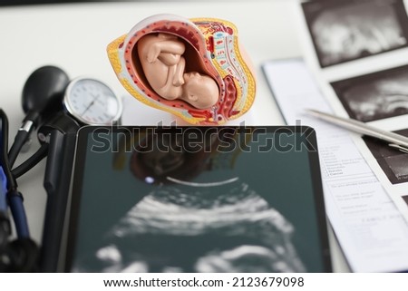 Model an uterus and a tablet with ultrasound on table