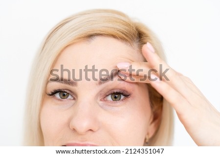 woman shows drooping eyelid for plastic surgery Royalty-Free Stock Photo #2124351047
