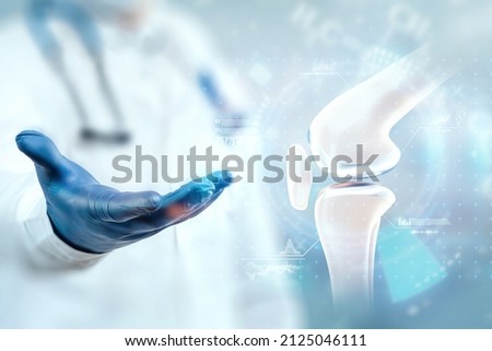 Medical poster image of the bones of the knee, the joint in the knee. Arthritis, inflammation, fracture, cartilage,. Copy space. Royalty-Free Stock Photo #2125046111