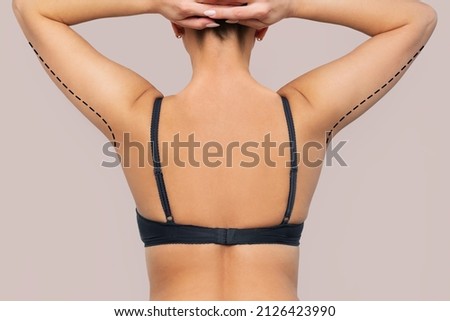 Cropped shot of a young woman with excess fat on her upper arm with marks for liposuction or plastic surgery isolated on a beige background. Loose and saggy muscles. Overweight. Beauty surgery concep Royalty-Free Stock Photo #2126423990