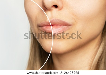 Cropped shot of young caucasian blonde woman's face with lips before and after lip enhancement. Injection of filler in lips. Result of a lip augmentation. Close up Royalty-Free Stock Photo #2126423996