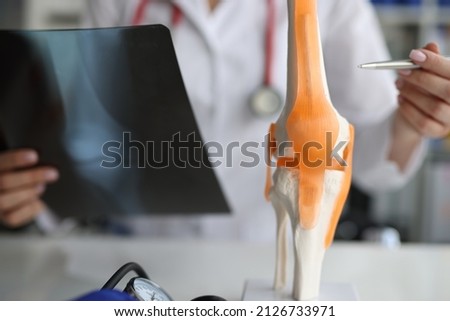 Doctor traumatologist demonstrating bones of knee joint on artificial model and taking xray picture closeup Royalty-Free Stock Photo #2126733971