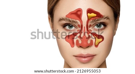 Sinusitis, frontitis. Female face with inflammation of mucous membrane of paranasal and frontal sinuses Royalty-Free Stock Photo #2126955053