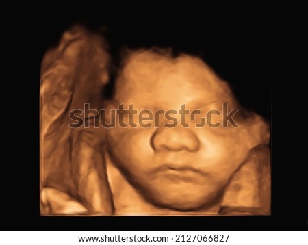 Ultrasound 3D 4D of baby in mother's womb.  Royalty-Free Stock Photo #2127066827