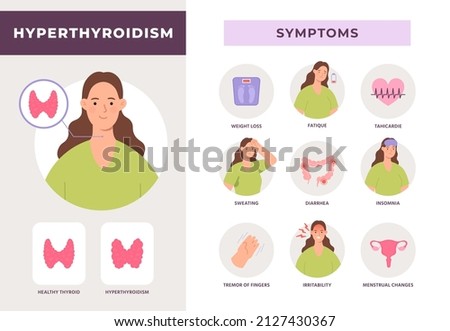 Hyperthyroidism symptoms infographic, overactive thyroid gland disease. Endocrine system health info with flat woman character vector poster. Illustration of disease hypothyroidism Royalty-Free Stock Photo #2127430367