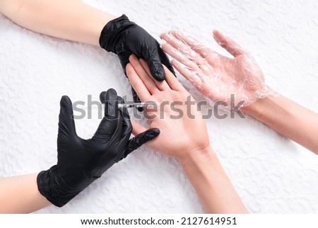 Palm hyperhidrosis treatment. Injection of a preparation containing botulinum toxin in palm to treat sweating. Blocking sweat glands with injections. Royalty-Free Stock Photo #2127614951