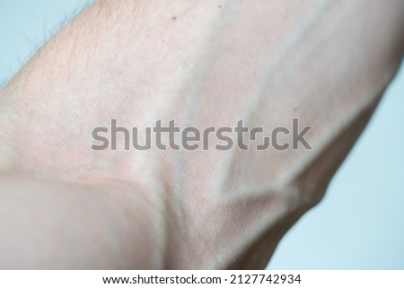Large bulging veins and arteries on a man's arm close up. Varicose veins. Elbow bend. Royalty-Free Stock Photo #2127742934