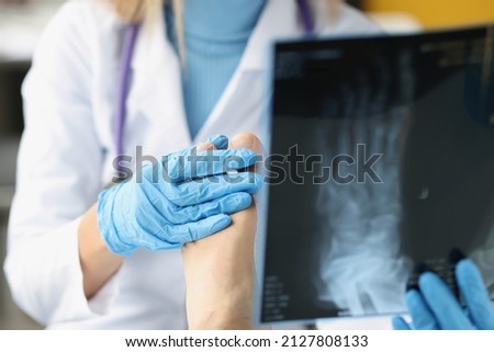 Female doctor examines x-ray of patient legs. Foot injury and sprain concept