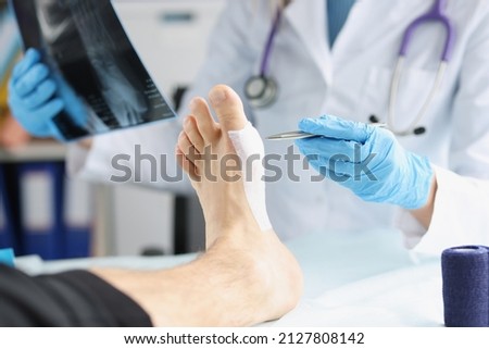 Doctor examines x-ray of dislocated leg of patient lies on table. Foot injury and sprain concept Royalty-Free Stock Photo #2127808142