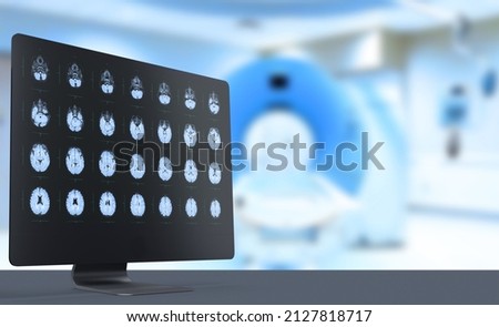 MRI, ultrasound, child's brain on the computer monitor in the CT room. Soft blurred background. Medical poster. kids vaccine Royalty-Free Stock Photo #2127818717