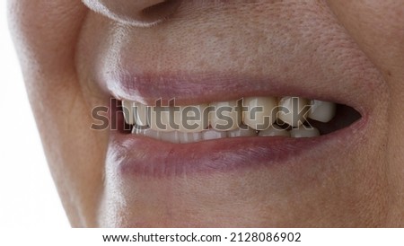 smile with dentures of an aged woman close-up