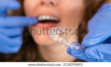 Orthodontist doctor in gloves putting silicone invisible transparent braces on woman's teeth in dentist clinic, mouth closeup view. Correcting teeth treatment and cure in dentistry. Royalty-Free Stock Photo #2128290893