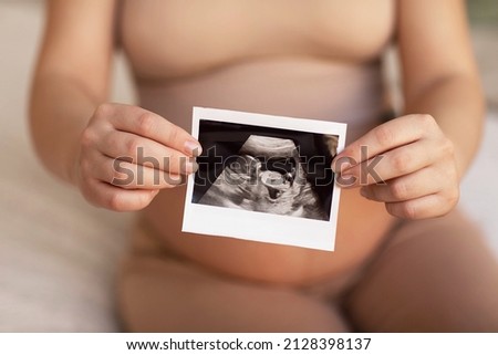 a pregnant girl holds in her hands a photo from an ultrasonic study of her unborn child. High quality photo
