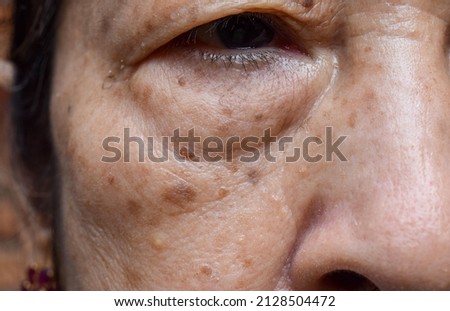 Small brown patches called age spots on face of Asian elder woman. They are also called liver spots, senile lentigo, or sun spots. Closeup view. Royalty-Free Stock Photo #2128504472