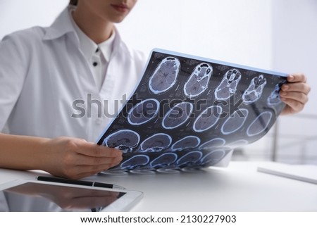 Doctor examining MRI images of patient with multiple sclerosis at table in clinic, closeup Royalty-Free Stock Photo #2130227903