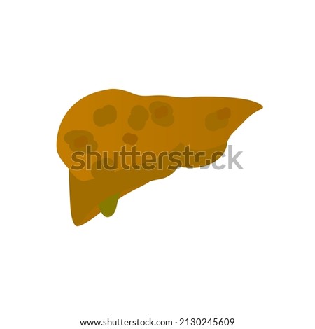 image of fatty liver, disease, vector illustration