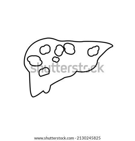 image of fatty liver, disease, vector illustration