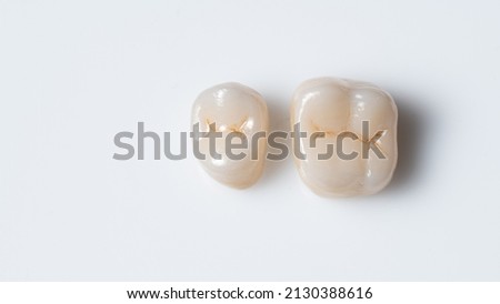 outside of dental crown beautiful tooth structure Royalty-Free Stock Photo #2130388616