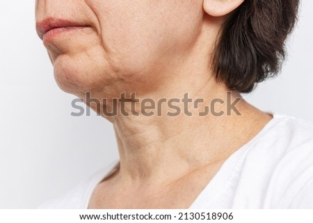 The lower part of elderly woman's face and neck with signs of skin aging isolated on a white background. Age-related changes, flabby sagging facial skin. Cosmetology and beauty concept Royalty-Free Stock Photo #2130518906