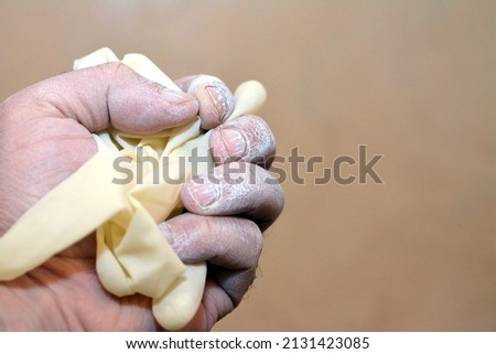 Selective focus of a human hand with a cornstarch powder clinging the skin from a worn medical powdered latex gloves causing allergy and hypersensitivity, powdered gloves are banned from usage by FDA Royalty-Free Stock Photo #2131423085