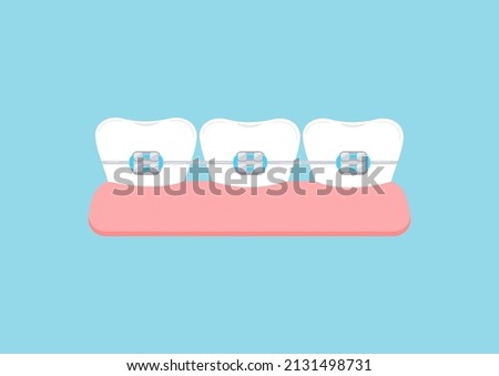 Teeth with dental braces in gym icon. Dental braces on white tooth orthodontic bracket correction treatment concept. Vector flat design cartoon style dentistry clip art illustration.
