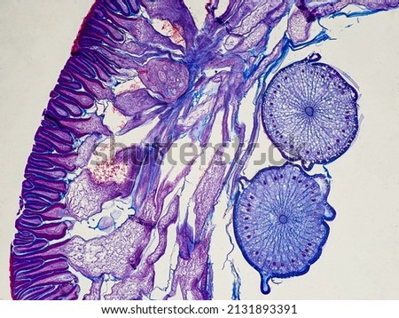 ascaris megalocephala cross section under the microscope showing its cuticle, mesodermal cells, pseudoceloma and ovaries - optical microscope x100 magnification