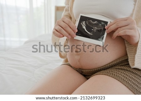 Close up of Pregnant Woman Showing Picture of Ultrasound of Baby in Tummy