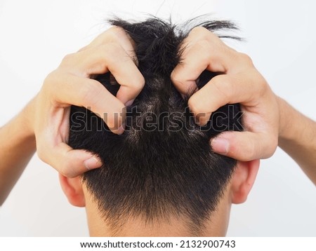 Asian man scratching on head from itching. closeup photo, blurred.