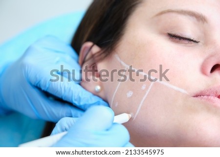 marking a girl's face to inject botulinum toxin to correct bruxism Royalty-Free Stock Photo #2133545975