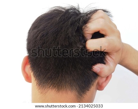 Asian man scratching on head from itching. closeup photo, blurred.