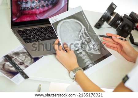 Dentist looking through x-ray photos of a patient with laptop and camera in stomatologic cabinet