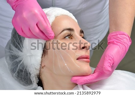 Thread lifting. Tightening of flabby skin in the jaw area with the help of cosmetic threads. Thread lifting. Tightening of flabby skin in the jaw area with the help of cosmetic threads. Royalty-Free Stock Photo #2135892979