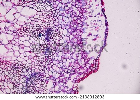 Host cells with spores (mold) are inside wood under the microscope for education.
 Royalty-Free Stock Photo #2136012803